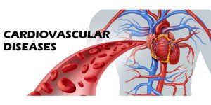 Cardiovascular diseases