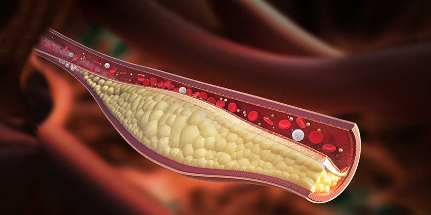  How Does CBD Oil Interact With Cholesterol Levels?