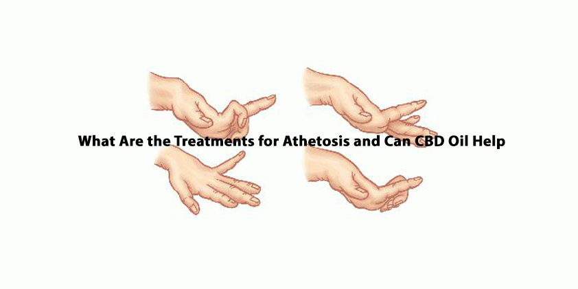 CBD for Athetosis (lead image)