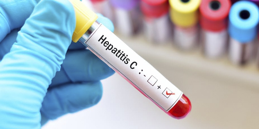  CBD as a Potential Treatment for Different Types of Hepatitis