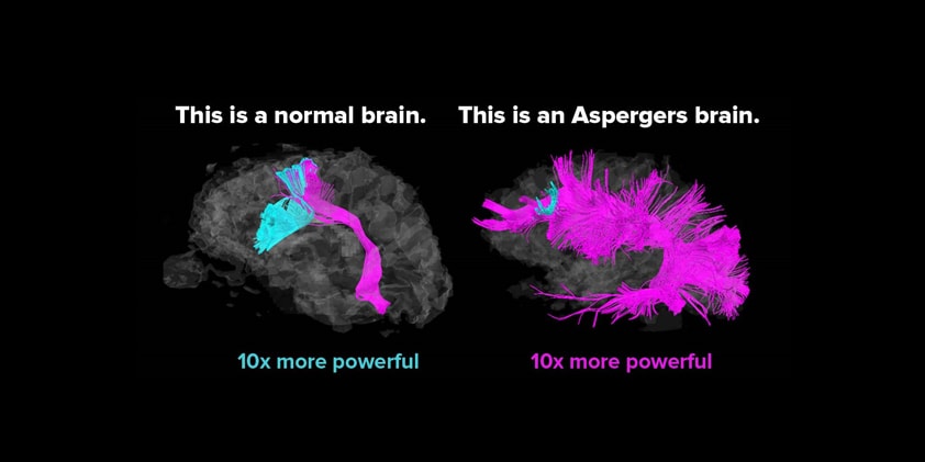 CBD and Asperger Syndrome (lead image)