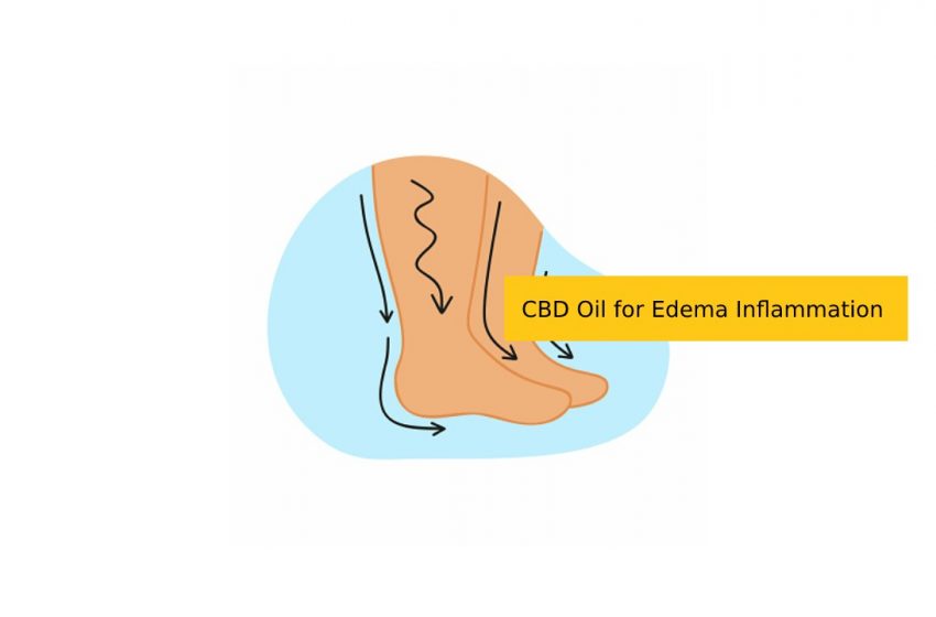 How CBD Oil Can Help With Edema Inflammation