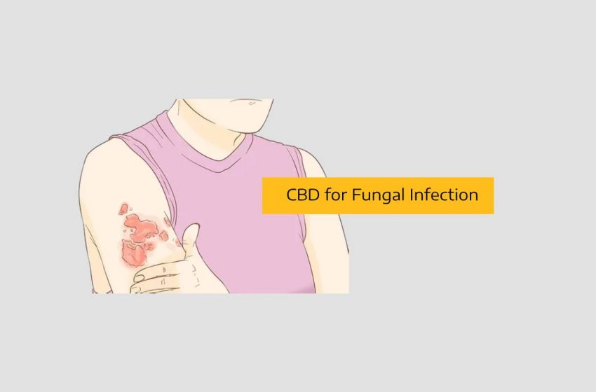  How CBD Can Alleviate Symptoms of Fungal Infection
