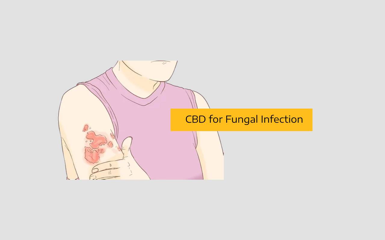 How CBD Can Alleviate Symptoms of Fungal Infection