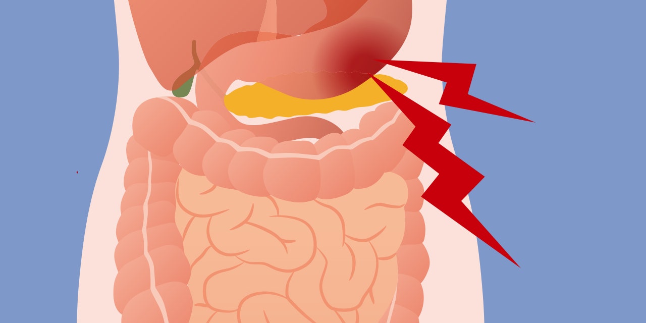 CBD May Reduce Stomach Pain and Inflammation (lead image)