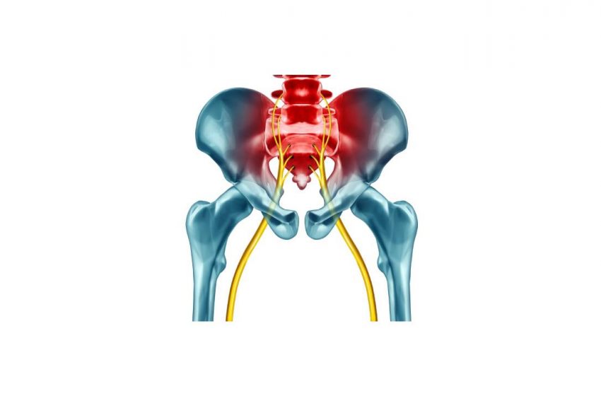  Can CBD Help Chronic Sciatica?