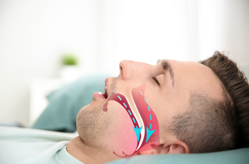  Can CBD Treat Sleep Apnea?