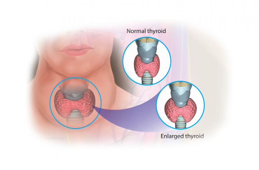  How This Cannabinoid Can Help Those With Inflamed Thyroids