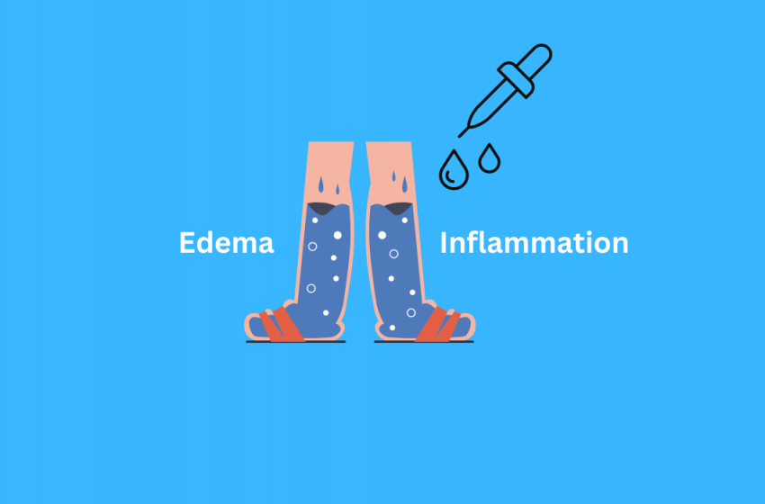  How CBD Oil Can Help With Edema Inflammation