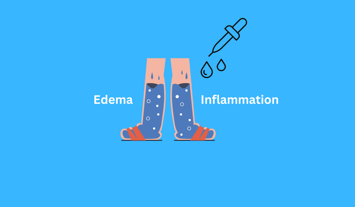 cbd oil for edema inflammation