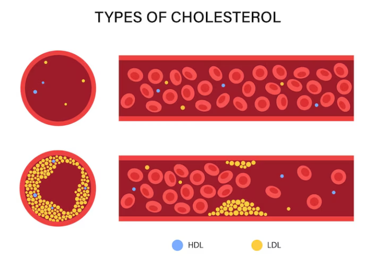 types of cholesterol smartcbdhub