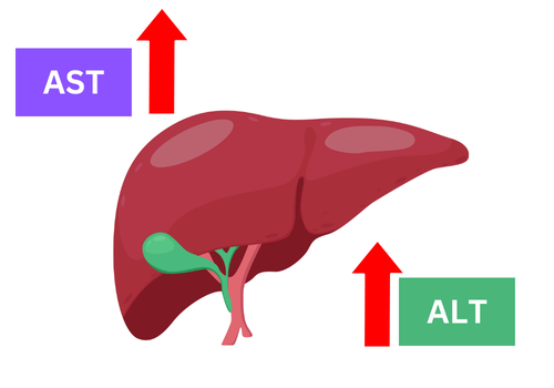 Abnormal Liver Enzymes